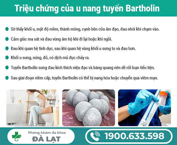 Hình ảnh minh họa